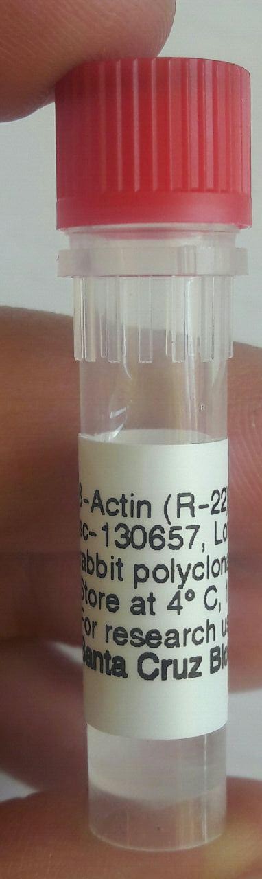 β-Actin Antibody (R-22): sc-130657 