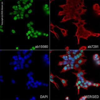 Anti-Ki67 antibody (ab15580) 100 ug