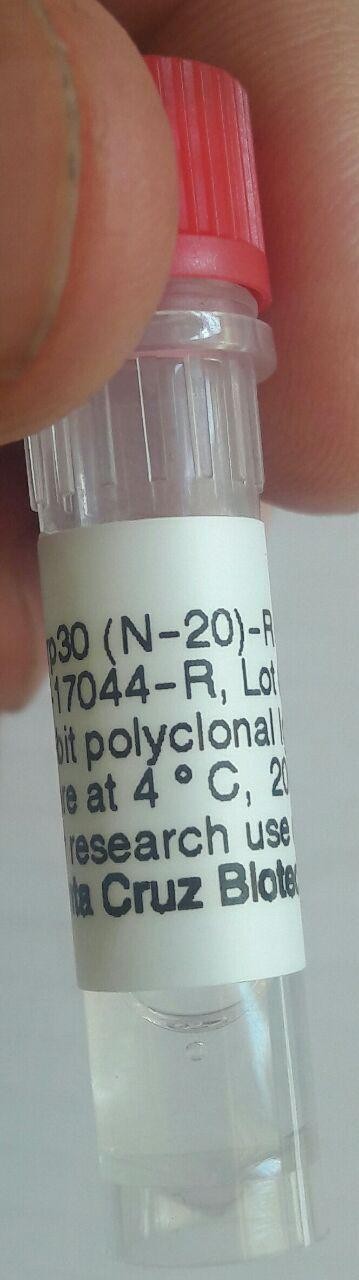 Acrp30 (N-20)-R Antibody : sc-17044-R 